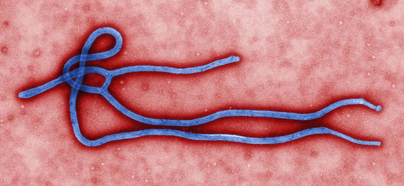 Virus del ébola